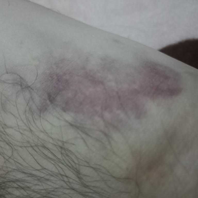 Dikkatsizlik Yüzünden Artan Kol Ağrısı