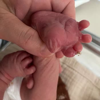 Doğum Sonrası İlgisizlik Ve Yetersiz Bilgilendirme