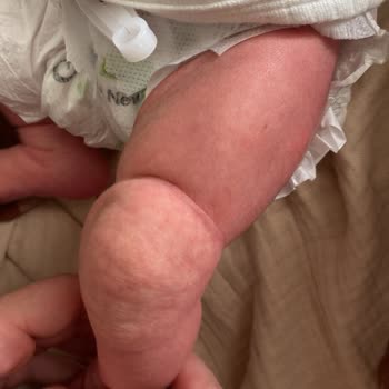 Doğum Sonrası İlgisizlik Ve Yetersiz Bilgilendirme