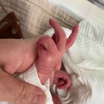 Doğum Sonrası İlgisizlik Ve Yetersiz Bilgilendirme