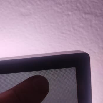 Philips TV Panel Sorunu Ve Yetersiz Servis Deneyimi