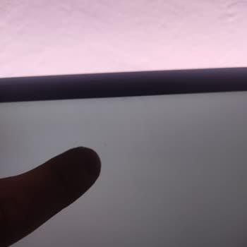 Philips TV Panel Sorunu Ve Yetersiz Servis Deneyimi