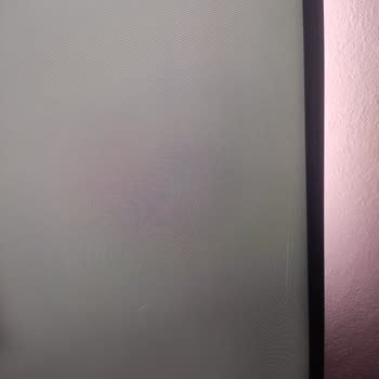 Philips TV Panel Sorunu Ve Yetersiz Servis Deneyimi