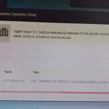 Başkent Kuaför Sıkıntısı