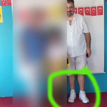 Skechers Ayakkabısında Beklenmedik Aşınma Ve Değişim Talebi