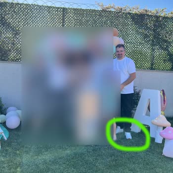 Skechers Ayakkabısında Beklenmedik Aşınma Ve Değişim Talebi