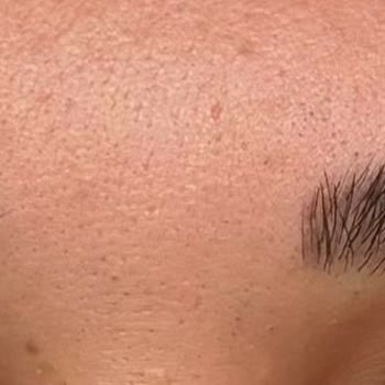 Güvenilmez Hizmet Ve Başarısız Kaş Tasarımı