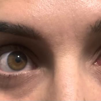 Cilt Bakımı Sonrası Gözlerimde Ciddi Sorunlar Yaşadım