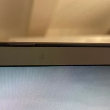 Üç Kez Servise Gönderilen Cihazda Çerçeve Sorunu Çözülemedi