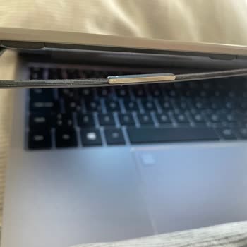 Üç Kez Servise Gönderilen Cihazda Çerçeve Sorunu Çözülemedi