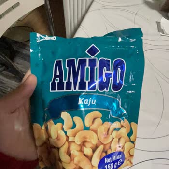 Amigo Kaju Paketinden Taş Çıkması Ve Sağlık Riski