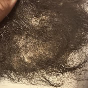 Dalgalı Saç Sistemi Hayal Kırıklığı