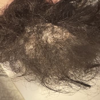 Dalgalı Saç Sistemi Hayal Kırıklığı