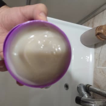 Hobby Matte Wax Saçlarımda Kepek Ve Yara Oluşturdu