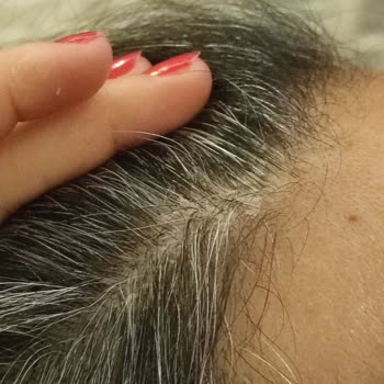 Hobby Matte Wax Saçlarımda Kepek Ve Yara Oluşturdu