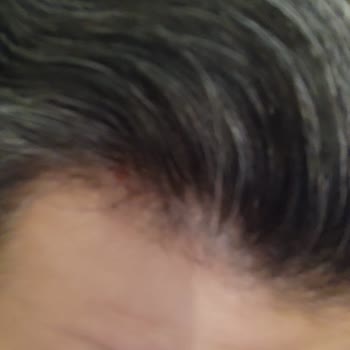 Hobby Matte Wax Saçlarımda Kepek Ve Yara Oluşturdu