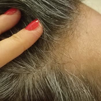 Hobby Matte Wax Saçlarımda Kepek Ve Yara Oluşturdu