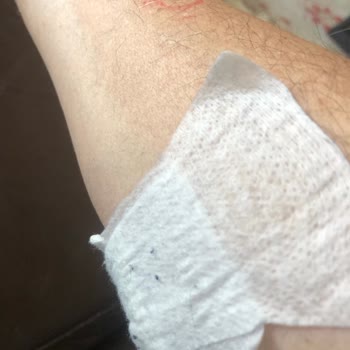 Medicana Beylikdüzü'nde Tomografi Çilesi