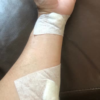 Medicana Beylikdüzü'nde Tomografi Çilesi