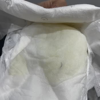 Bebek Bezinde Beklenmedik Yabancı Madde