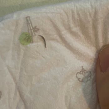 Bebek Bezinde Beklenmedik Yabancı Madde