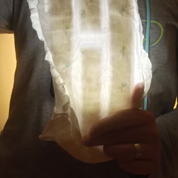 Sleepy Bio Naturel Bebek Bezlerinde Kalite Düşüşü Ve İade Sorunu