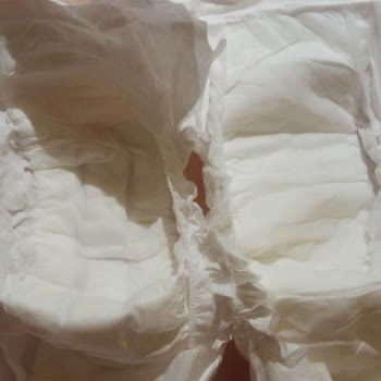 Sleepy Bio Naturel Bebek Bezlerinde Kalite Düşüşü Ve İade Sorunu