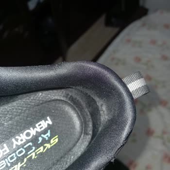 Skechers Ayakkabılarla Yürüyüş Keyfi Kabusa Döndü!