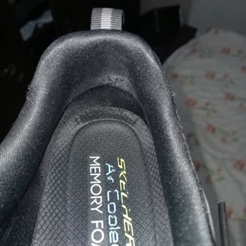 Skechers Ayakkabılarla Yürüyüş Keyfi Kabusa Döndü!