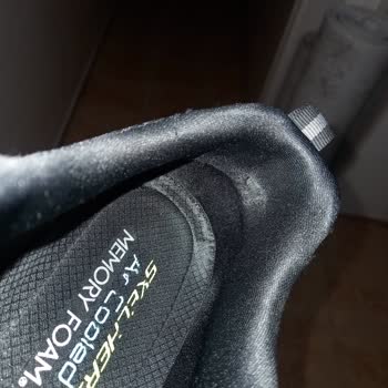 Skechers Ayakkabılarla Yürüyüş Keyfi Kabusa Döndü!