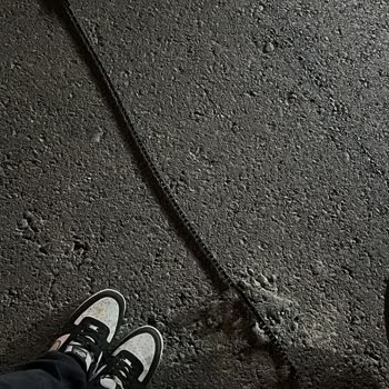 Zincir Kopması Ve Parça Eksikliği Mağduriyeti