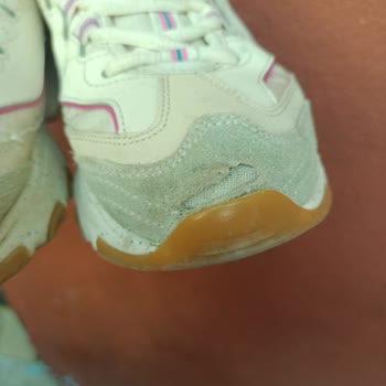 Ayakkabının 6 Ayda Patlaması Ve İade Reddi