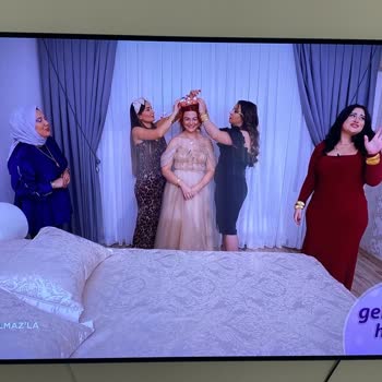 Philips OLED TV: Sürekli Kararan Ekran Ve Yetersiz Servis Desteği