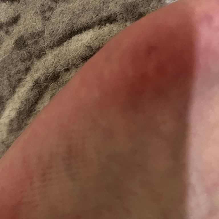 Sneaks Up Ayakkabı Kullanımı Sonrası Yaşanan Sorunlar