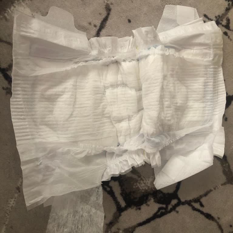 Molfix Bebek Bezlerinde Üretim Hatası