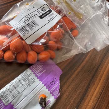 Taş Çıkan Cips Fıstık Diş Kırdı Müşteri Hizmetleri İlgisiz