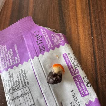 Taş Çıkan Cips Fıstık Diş Kırdı Müşteri Hizmetleri İlgisiz