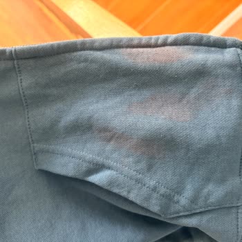 Leke Çıkarıcı Yüzünden Renk Değişimi Sorunu