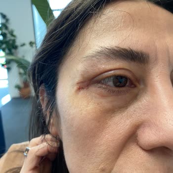 Medistanbul Hastanesi Başarısız Ameliyatın Ücret İadesi Yapılmadı!