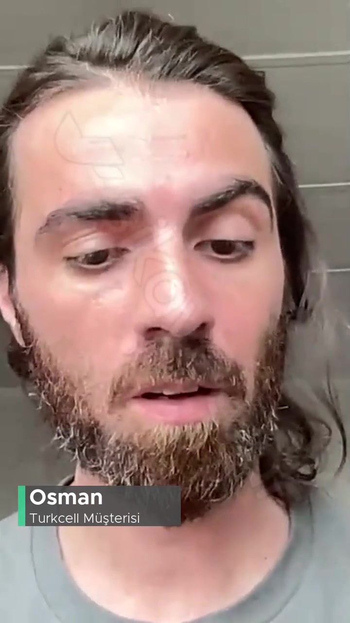 Turkcell Hattım Yurt Dışında Aktif Görünse De SMS Veya Aramalara Kapalı videonun kapak resmi