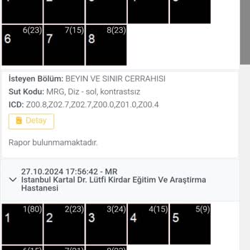 Hastanede Sol Diz MR Raporu Çıkmıyor