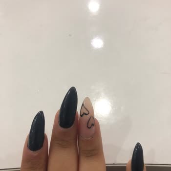 Randevu Gecikmesi Ve Kötü Hizmet Deneyimi