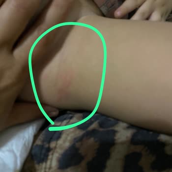 Baby Turco Bebek Bezlerinde Boyut Sorunu Ve İade Problemi