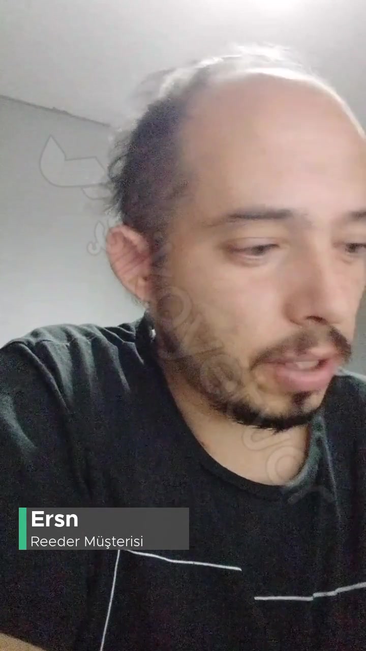 Reeder Cihaz Mağduriyeti! videonun kapak resmi