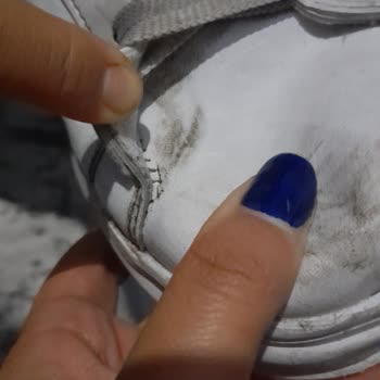 Garanti Kapsamındaki Ayakkabının Dikiş Sorunu