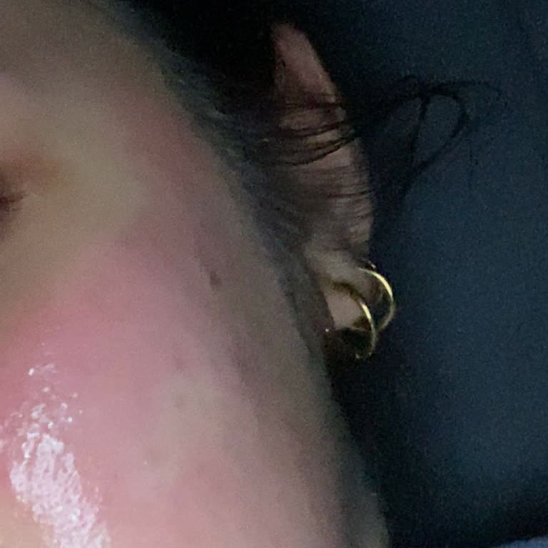 Claderm Kil Maskesi Cilt Yanması Ve Ürün Kalite Sorunu