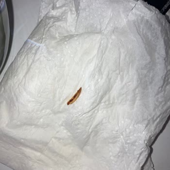 Lokumdan Çıkan Fare Dişi Şoku