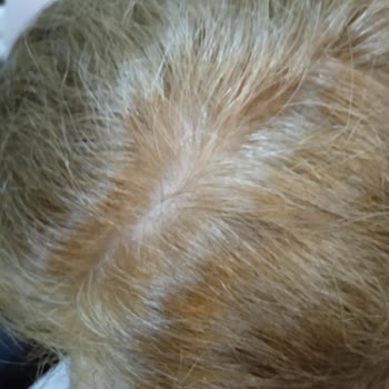 Saç Boyası Hayal Kırıklığı: Green Therapy 8.3