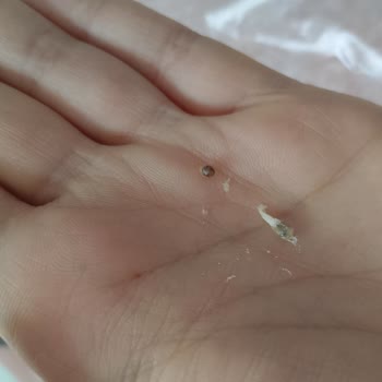 Sağlık Tehlikesi: Pişmaniye İçindeki Yabancı Maddeler