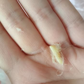 Sağlık Tehlikesi: Pişmaniye İçindeki Yabancı Maddeler